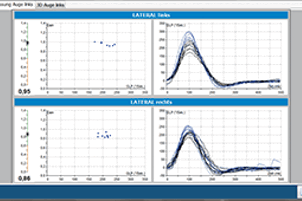 HeadStar VHIT goggle