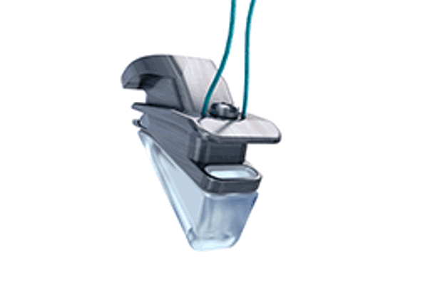 Vocal fold medialisation implant