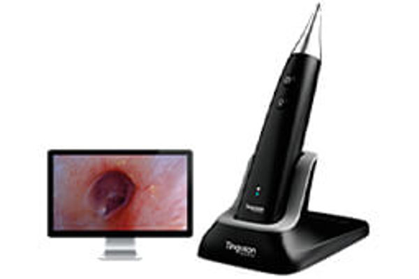Wireless HD Otoscope