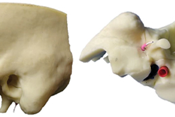 3D Temporal Bone Model