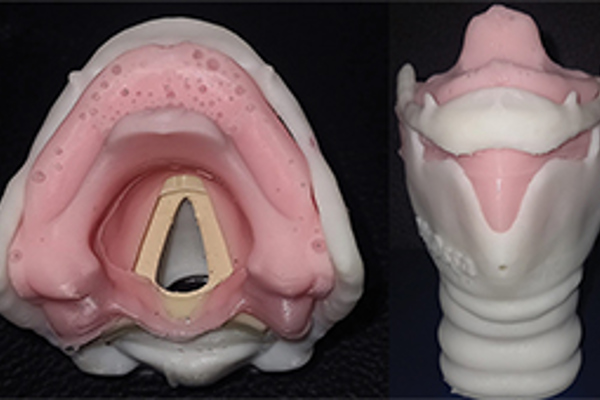 3D Larynx model