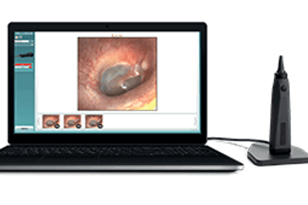 Viot™ – Video otoscope