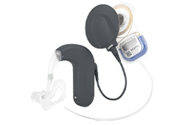 SYNCHRONY EAS Hearing Implant System